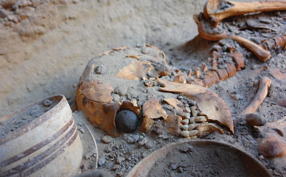 The World's Oldest Known Artificial Eye The World's Oldest Known Artificial Eye